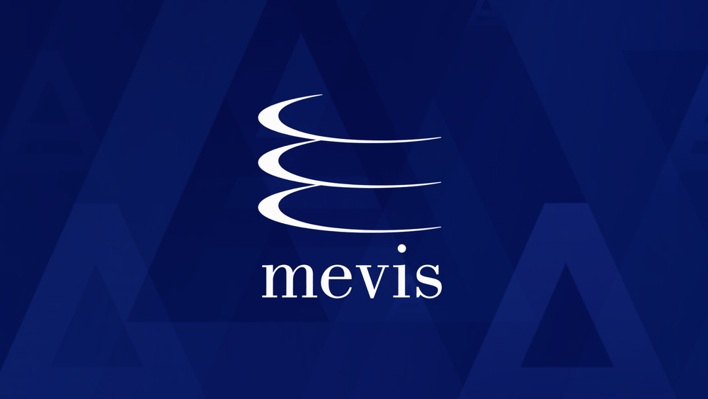 Mevis eliminates backup downtime with Acronis Cyber Protect for OT